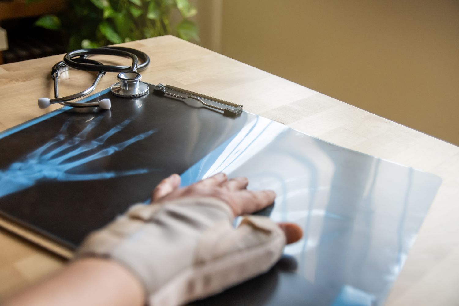 personal-injury-lawyers Common Injuries Which Lead People to Seek a Personal Injury Lawyer